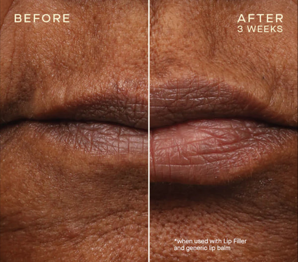 Lip Filler with Subtopical Plumping Technology™